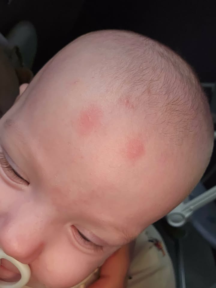 640161260_781941518296961_43246954893080242_n Pluskwy w jednym z bloków przy ul. Lipowej w Wągrowcu? Mieszkaniec alarmuje o problemie